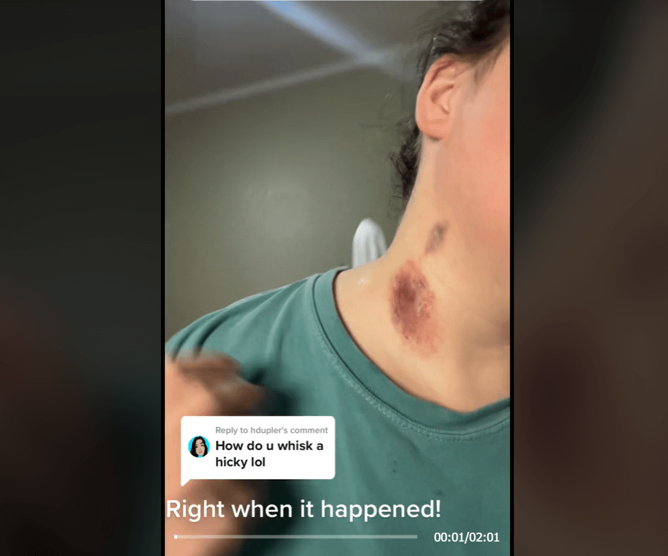 TikTok Hickey Whisk Trend